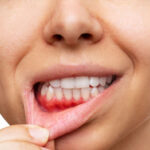 Cuidado Salud Oral Embarazo