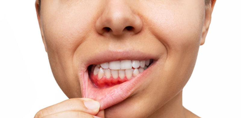 Cuidado Salud Oral Embarazo