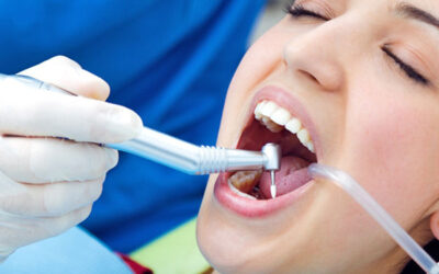 Qué Debes Saber Sobre las Limpiezas Dentales