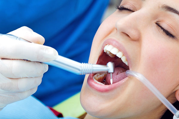 Limpieza Dental Madrid Precio